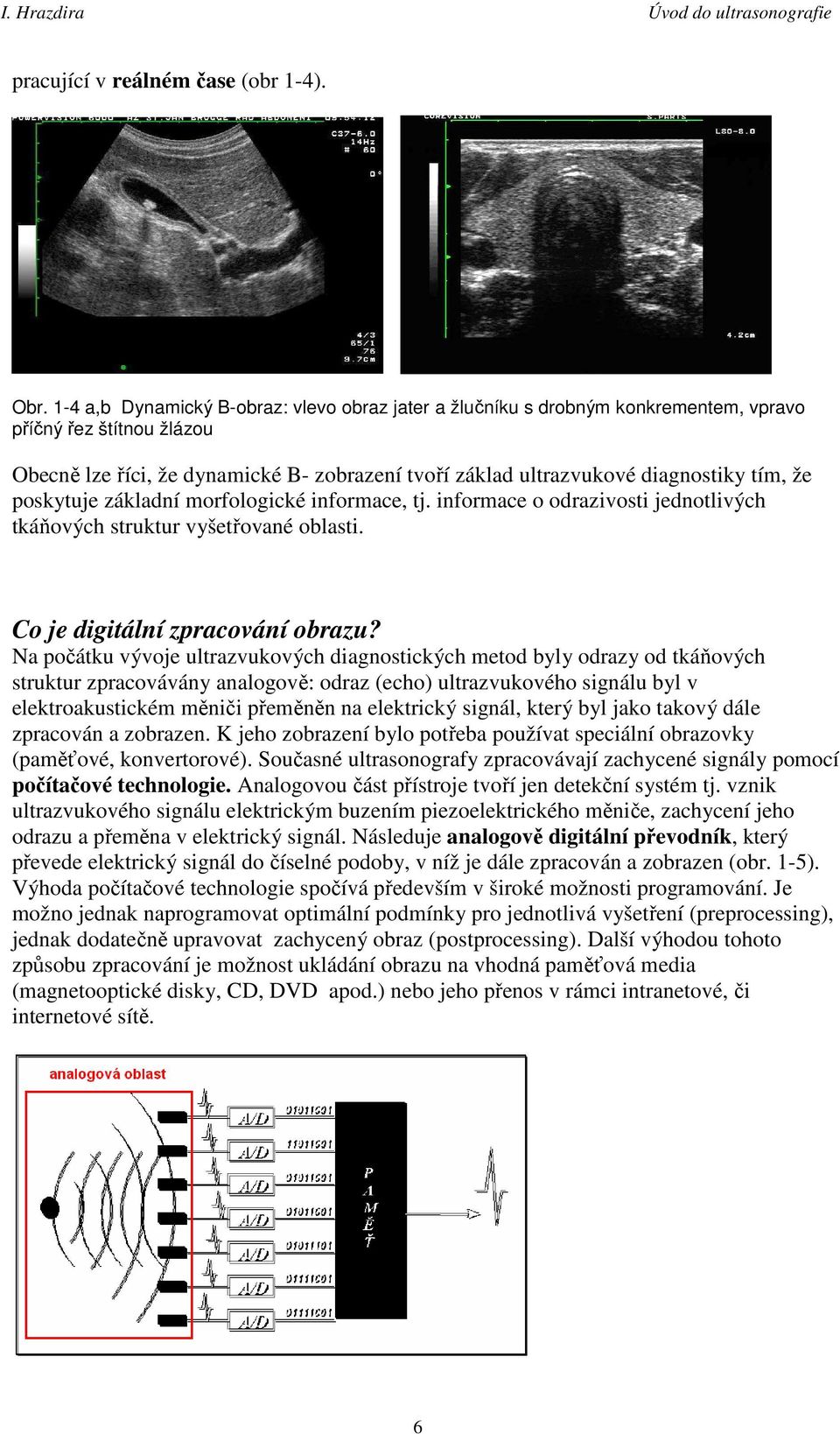 že poskytuje základní morfologické informace, tj. informace o odrazivosti jednotlivých tkáňových struktur vyšetřované oblasti. Co je digitální zpracování obrazu?