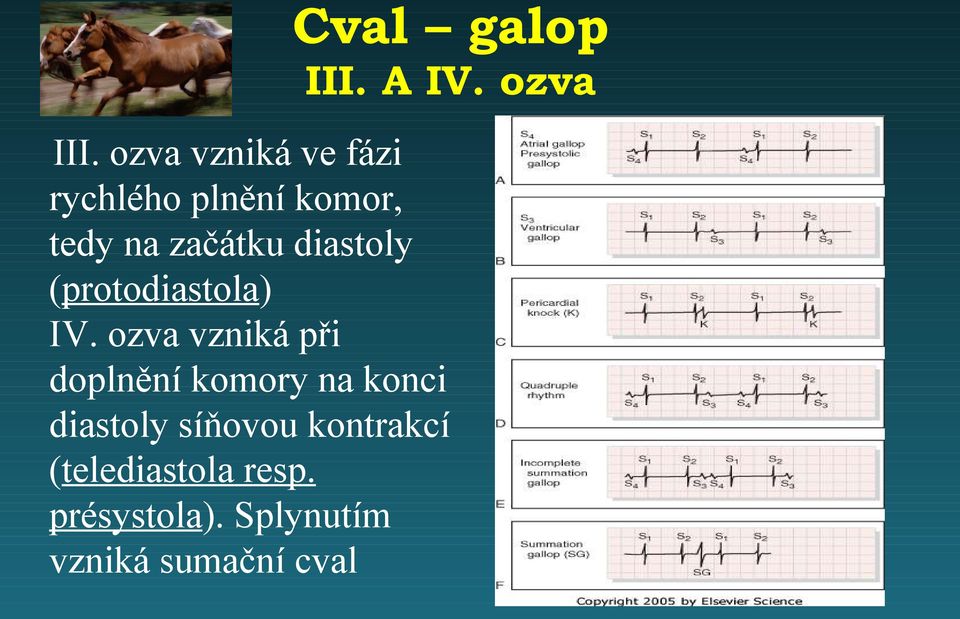 diastoly (protodiastola) IV.