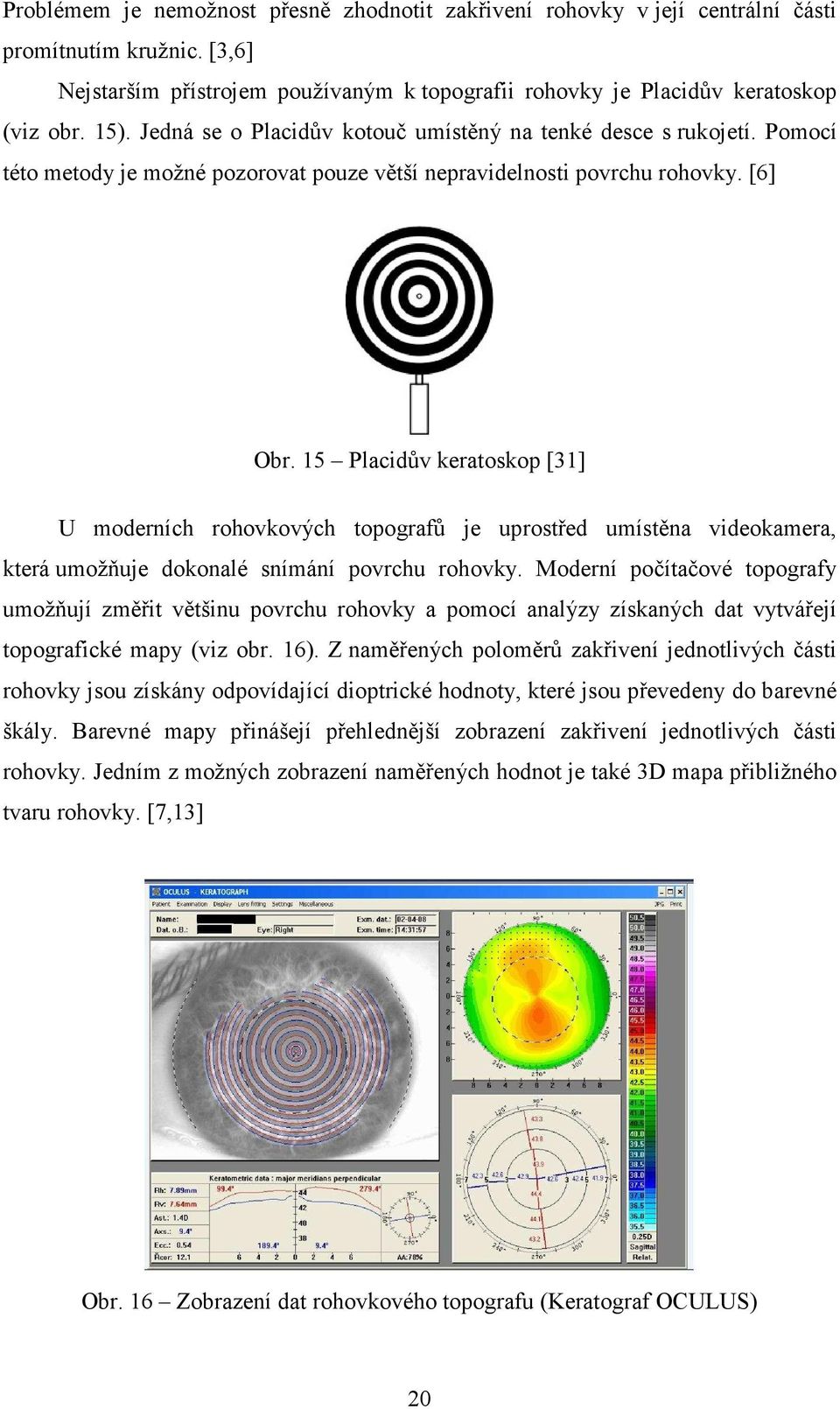 15 Placidův keratoskop [31] U moderních rohovkových topografů je uprostřed umístěna videokamera, která umožňuje dokonalé snímání povrchu rohovky.