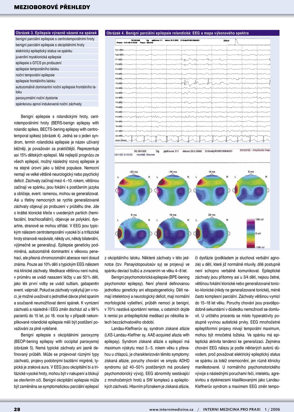 myoklonická epilepsie epilepsie s GTCS po probuzení epilepsie temporálního laloku noční temporální epilepsie epilepsie frontálního laloku autozomálně dominantní noční epilepsie frontálního laloku