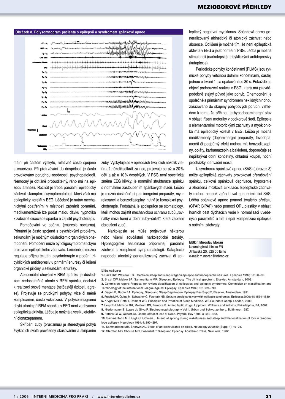 Rozlišit je třeba parciální epileptický záchvat s komplexní symptomatologií, který však má epileptický korelát v EEG.