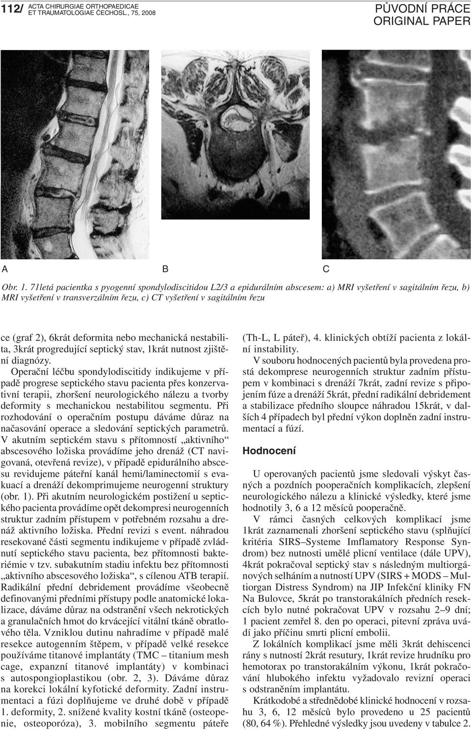 6krát deformita nebo mechanická nestabilita, 3krát progredující septický stav, 1krát nutnost zjištění diagnózy.