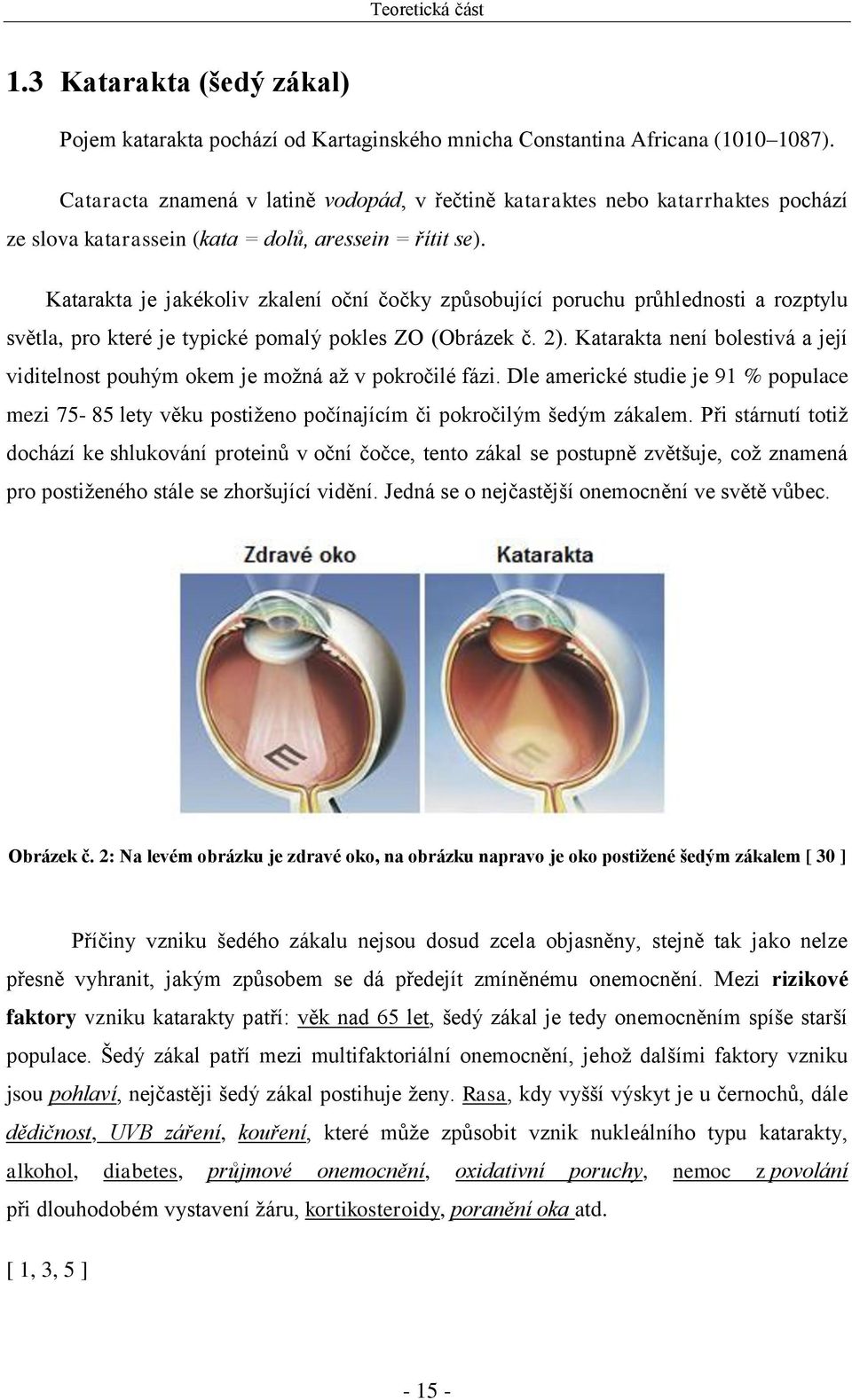 Katarakta je jakékoliv zkalení oční čočky způsobující poruchu průhlednosti a rozptylu světla, pro které je typické pomalý pokles ZO (Obrázek č. 2).