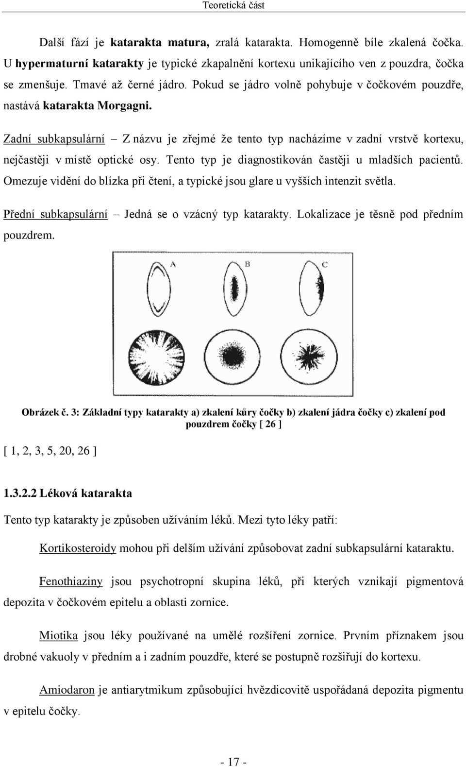 Zadní subkapsulární Z názvu je zřejmé že tento typ nacházíme v zadní vrstvě kortexu, nejčastěji v místě optické osy. Tento typ je diagnostikován častěji u mladších pacientů.