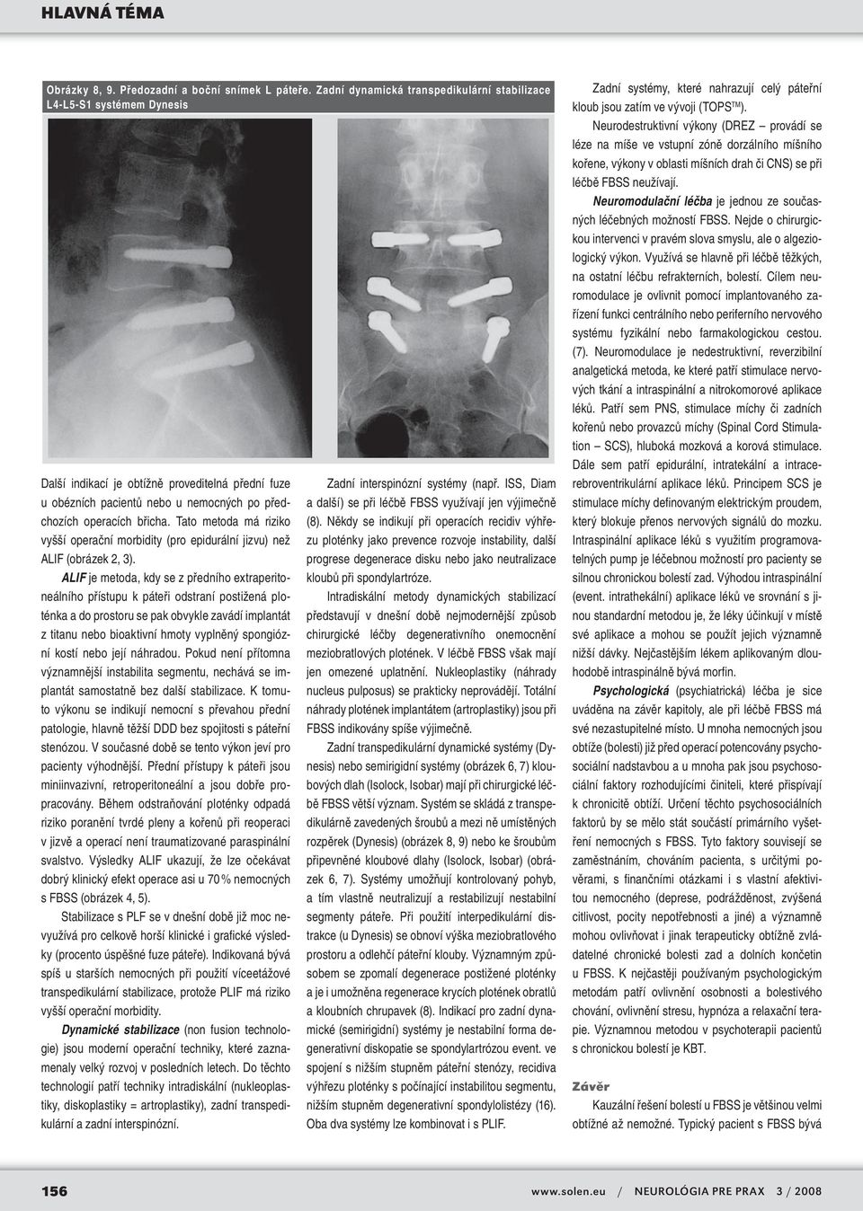 Tato metoda má riziko vyšší operační morbidity (pro epidurální jizvu) než ALIF (obrázek 2, 3).