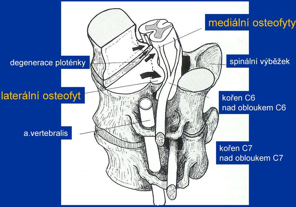 osteofyt a.