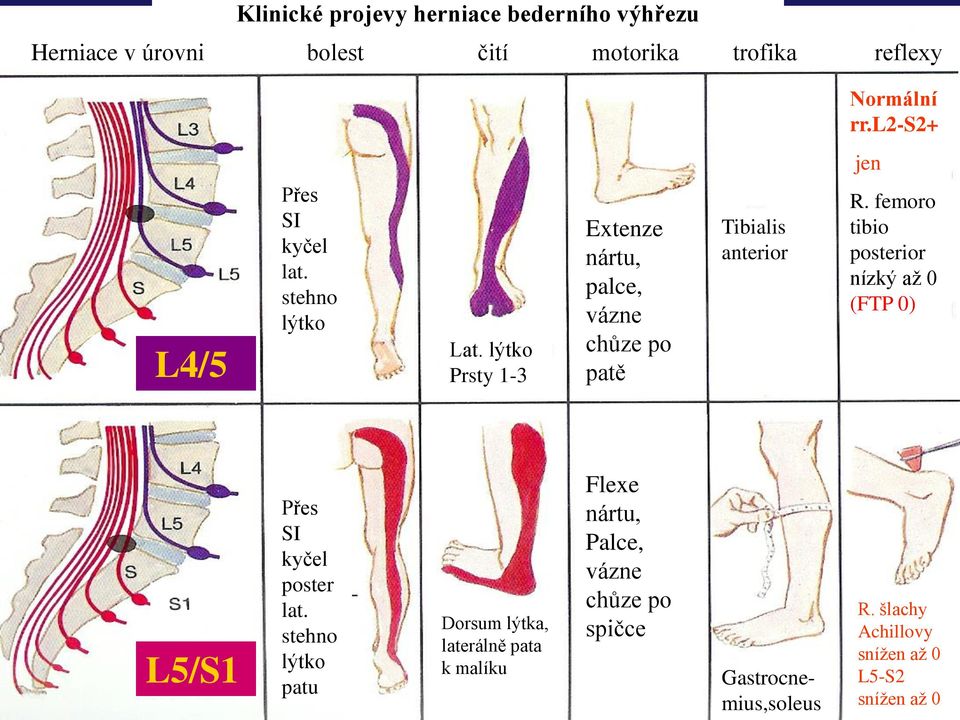 femoro tibio posterior nízký až 0 (FTP 0) L5/S1 Přes SI kyčel poster lat.