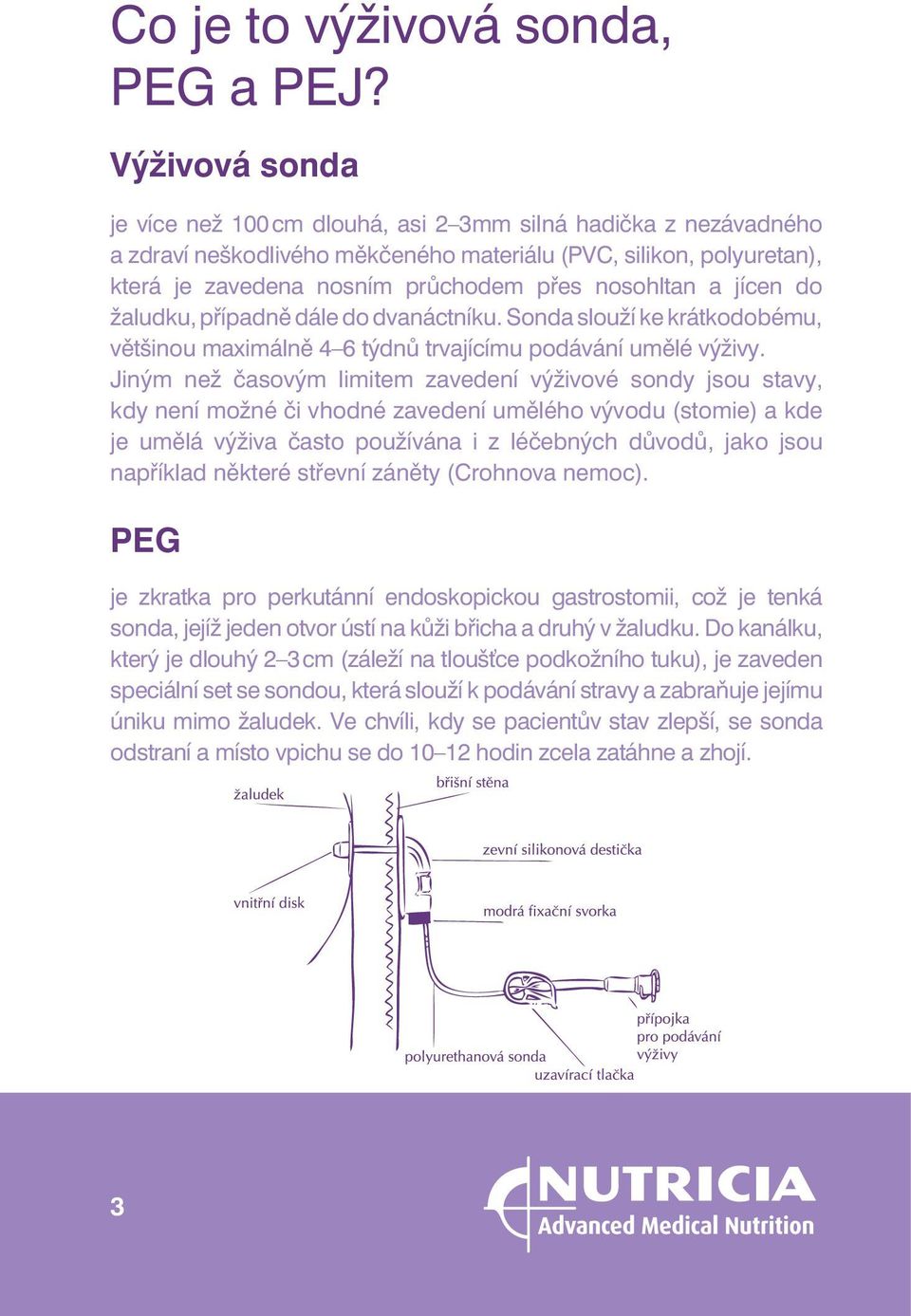 a jícen do žaludku, případně dále do dvanáctníku. Sonda slouží ke krátkodobému, většinou maximálně 4 6 týdnů trvajícímu podávání umělé výživy.