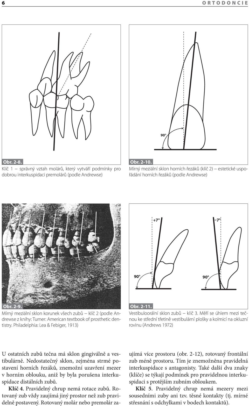 Mírný meziální sklon korunek všech zubů klíč 2 (podle Andrewse z knihy: Turner: American textbook of prosthetic dentistry. Philadelphia: Lea & Febiger, 1913) Obr. 2-11.