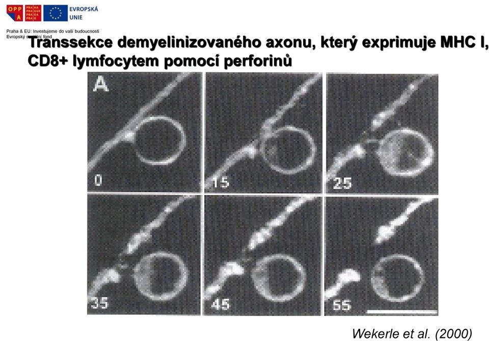 I, CD8+ lymfocytem pomocí