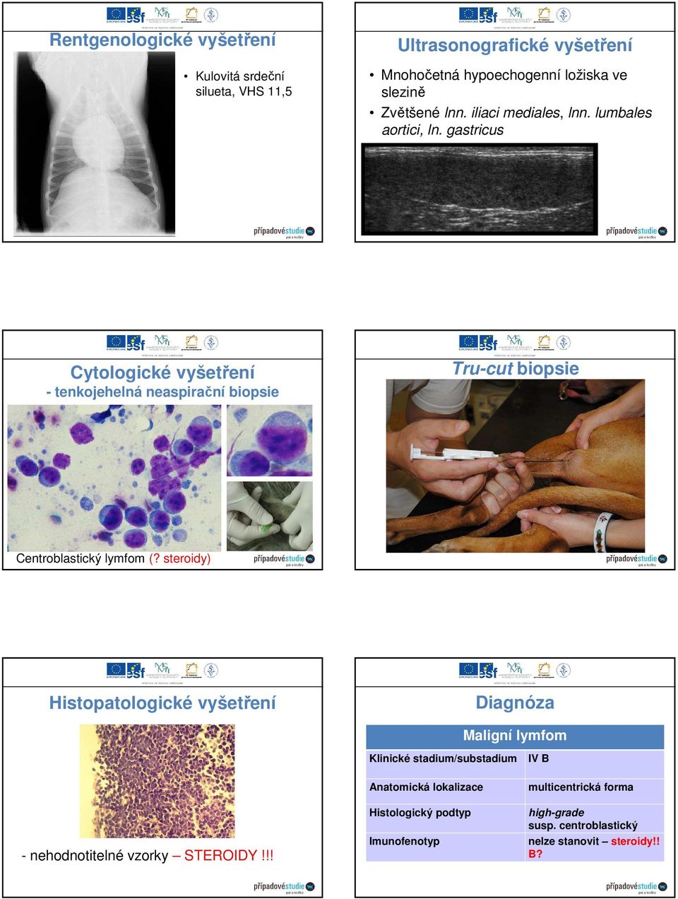 gastricus Cytologické vyšetření - tenkojehelná neaspirační biopsie Tru-cut biopsie Centroblast Centroblastický lymfom (?