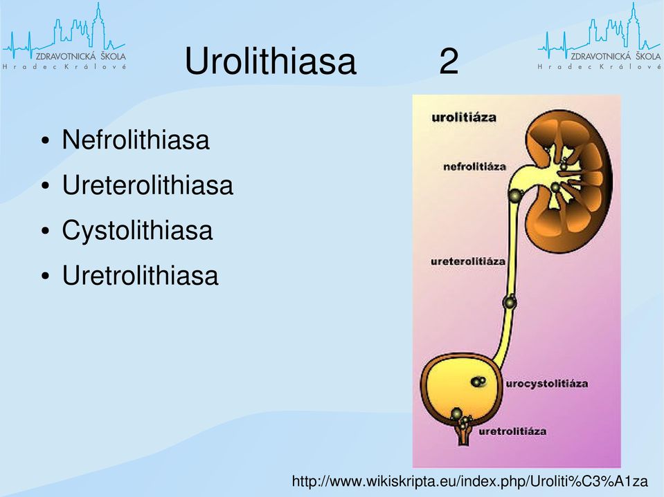 Uretrolithiasa http://www.