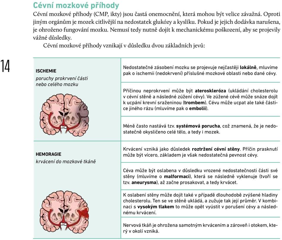 Cévní mozkové příhody vznikají v důsledku dvou základních jevů: ISCHEMIE poruchy prokrvení části nebo celého mozku Nedostatečné zásobení mozku se projevuje nejčastěji lokálně, mluvíme pak o ischemii