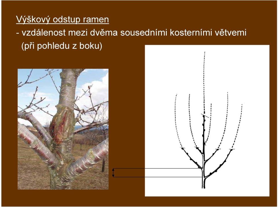 sousedními kosterními