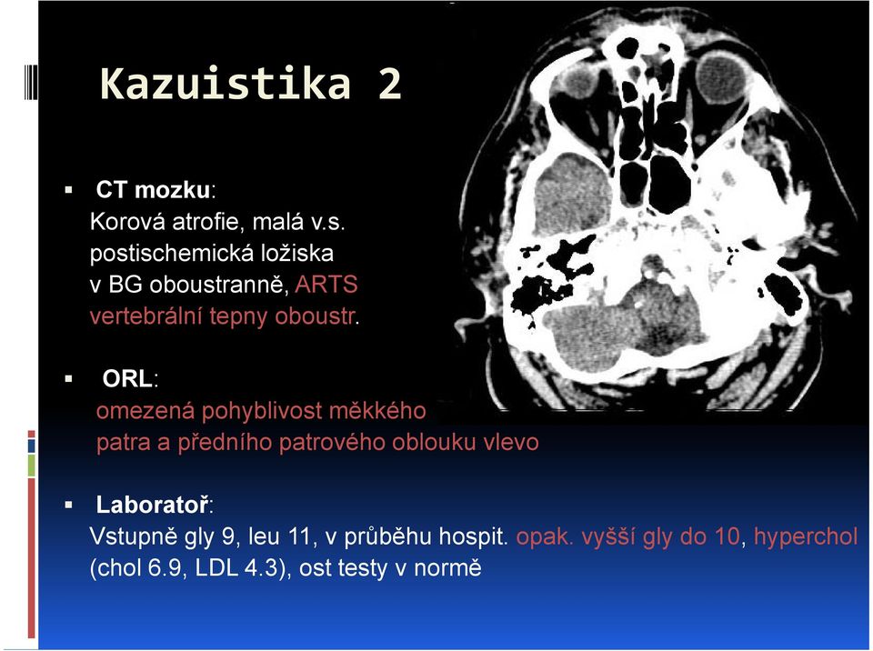 Laboratoř: Vstupně gly 9, leu 11, v průběhu hospit. opak.