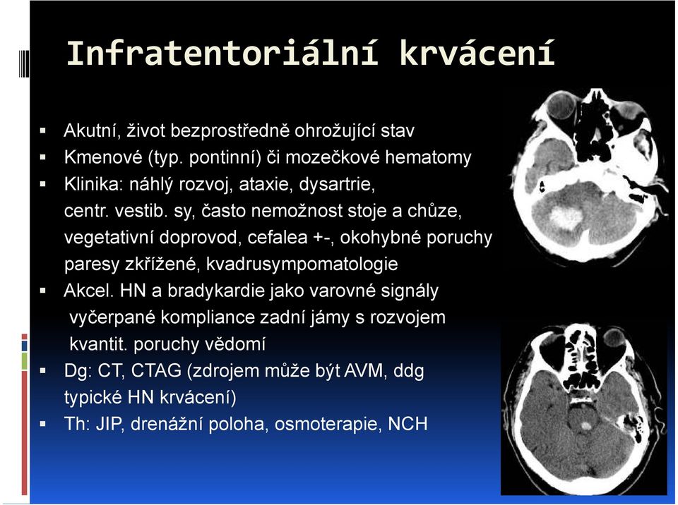 sy, často nemožnost stoje a chůze, vegetativní doprovod, cefalea +-, okohybné poruchy paresy zkřížené, kvadrusympomatologie