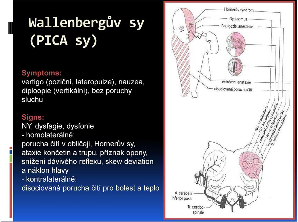 čití v obličeji, Hornerův sy, ataxie končetin a trupu, příznak opony, snížení dávivého