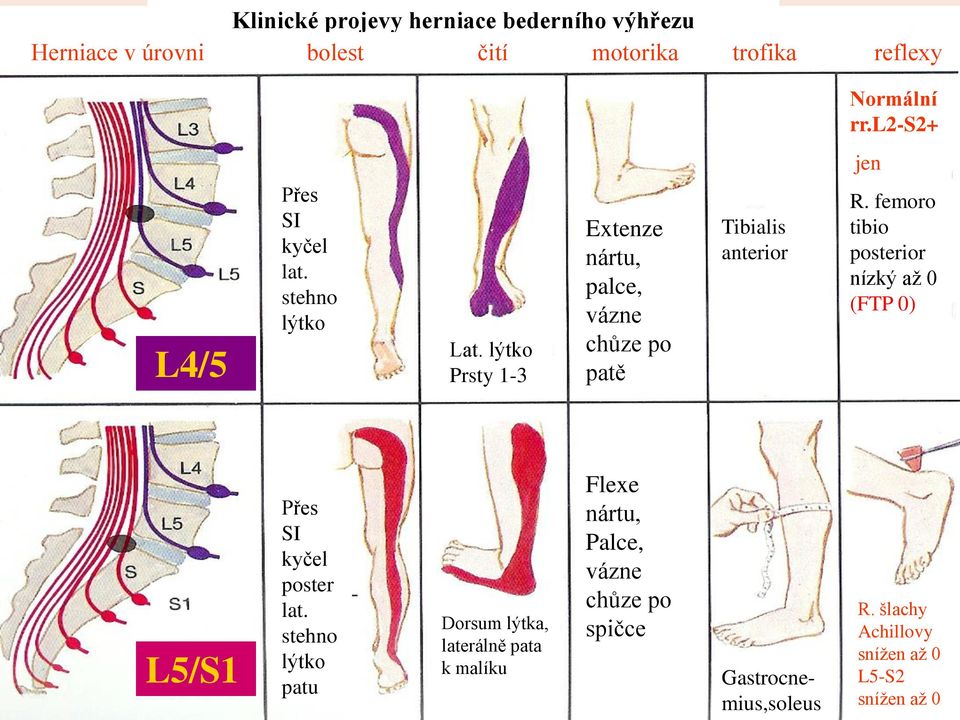 lýtko Prsty 1-3 Extenze nártu, palce, vázne chůze po patě Tibialis anterior R.