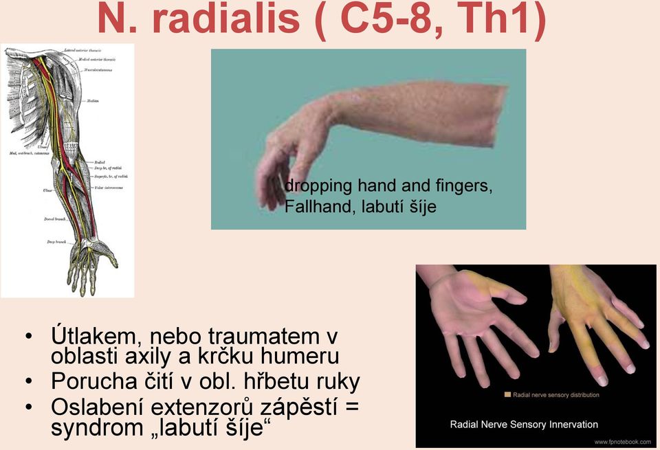 oblasti axily a krčku humeru Porucha čití v obl.