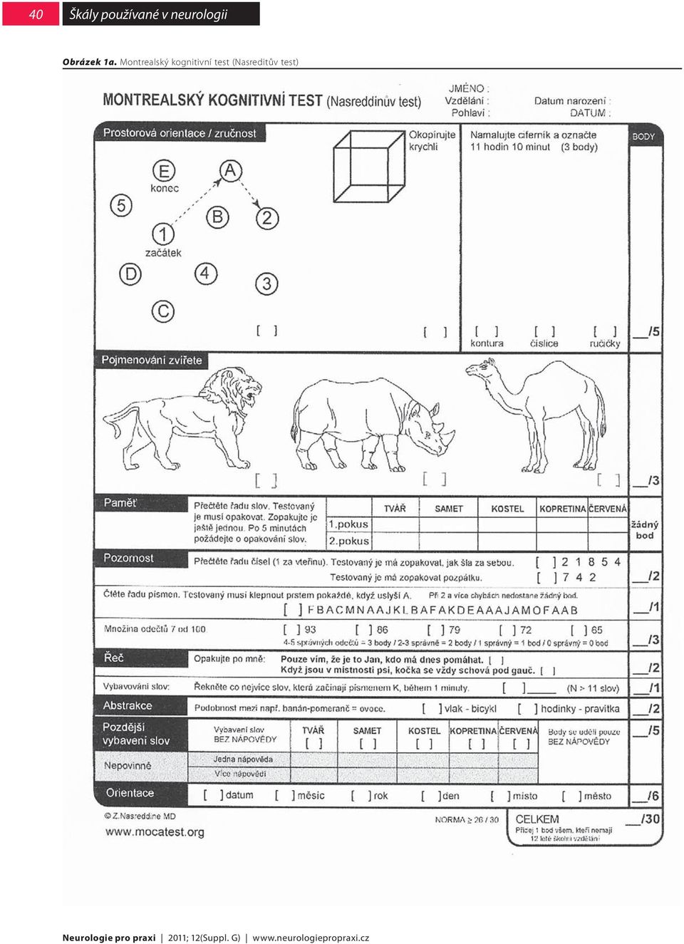 Montrealský kognitivní test