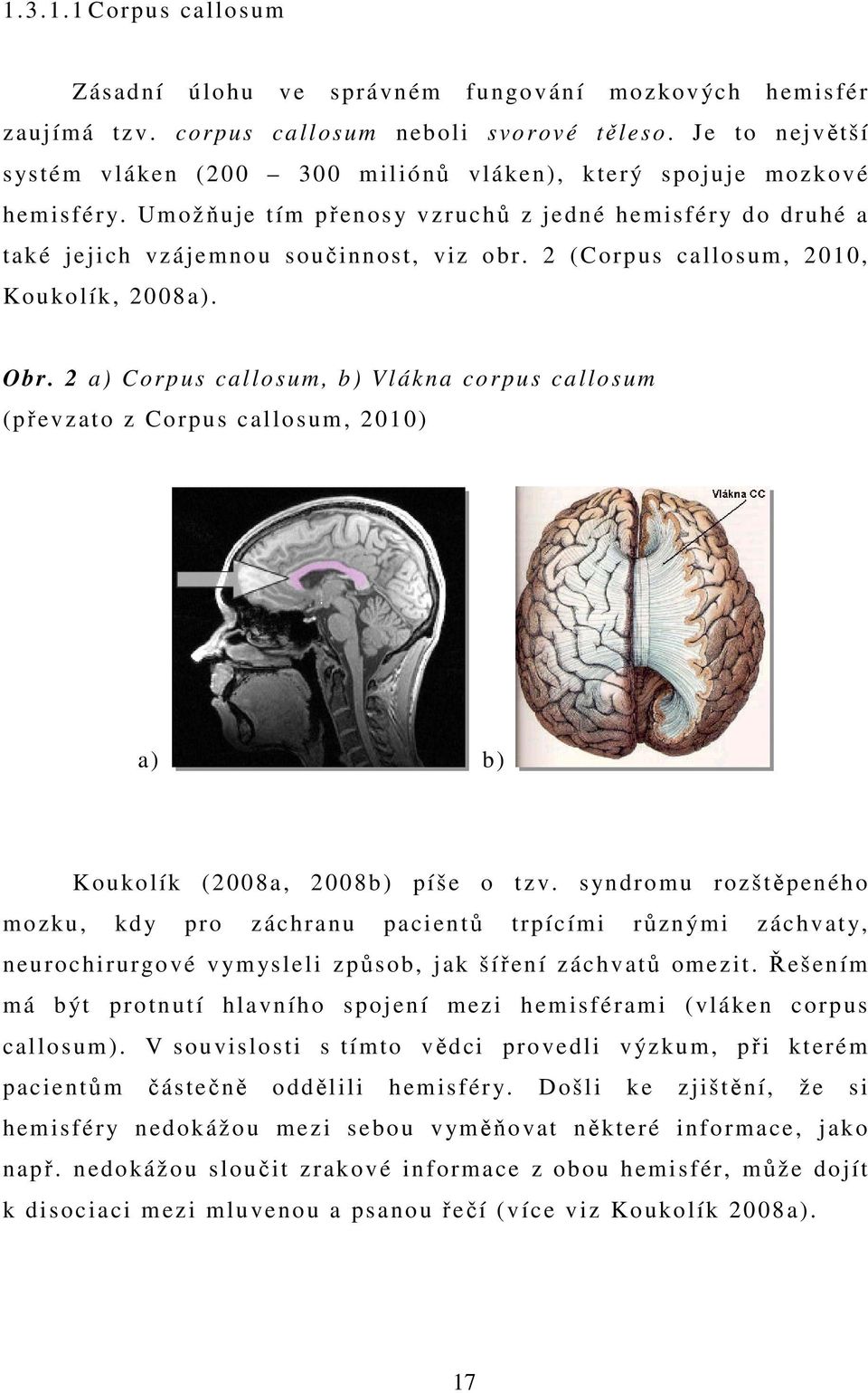 2 (Corpus callosum, 2010, Koukolík, 2008a). Obr. 2 a) Corpus callosum, b) Vlákna corpus callosum (převzato z Corpus callosum, 2010) a) b) Koukolík (2008a, 2008b) píše o tzv.