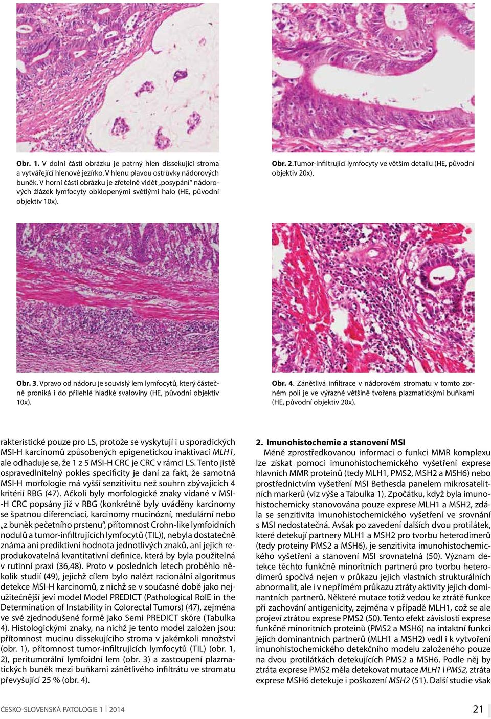 Tumor-infiltrující lymfocyty ve větším detailu (HE, původní objektiv 20x). Obr. 3.