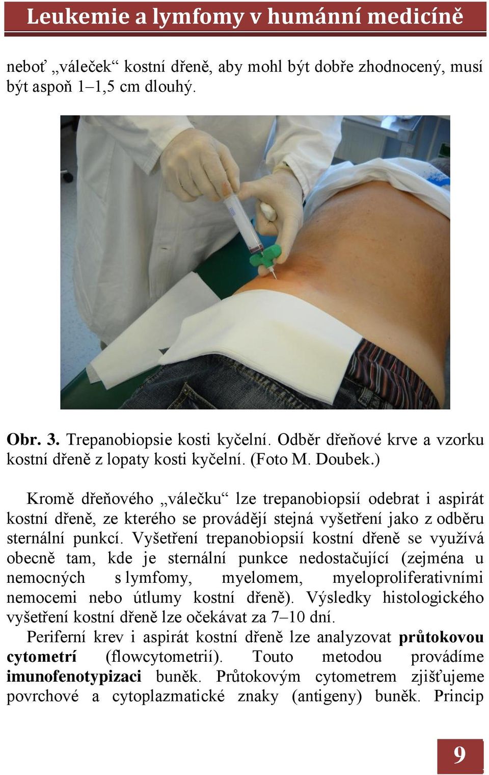 Vyšetření trepanobiopsií kostní dřeně se využívá obecně tam, kde je sternální punkce nedostačující (zejména u nemocných s lymfomy, myelomem, myeloproliferativními nemocemi nebo útlumy kostní dřeně).