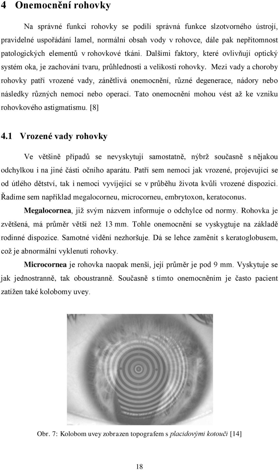 Mezi vady a choroby rohovky patří vrozené vady, zánětlivá onemocnění, různé degenerace, nádory nebo následky různých nemocí nebo operací.