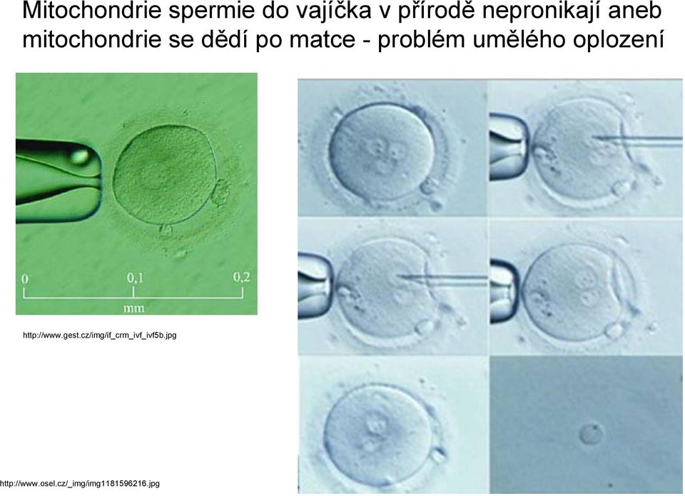 problém umělého oplození http://www.gest.