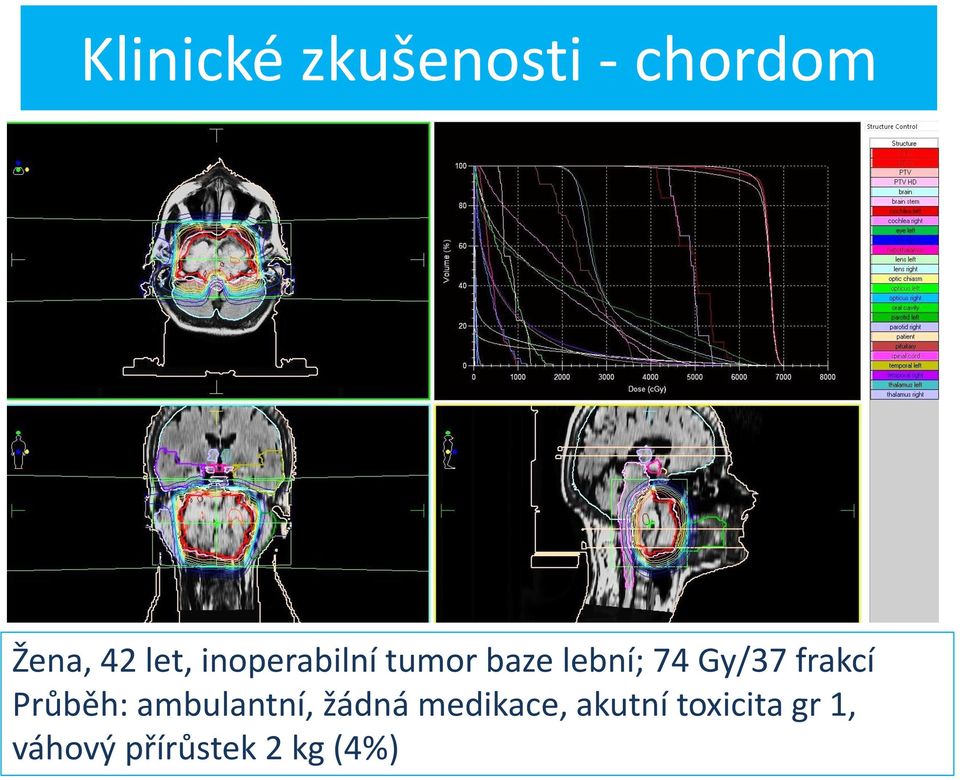 frakcí Průběh: ambulantní, žádná medikace,