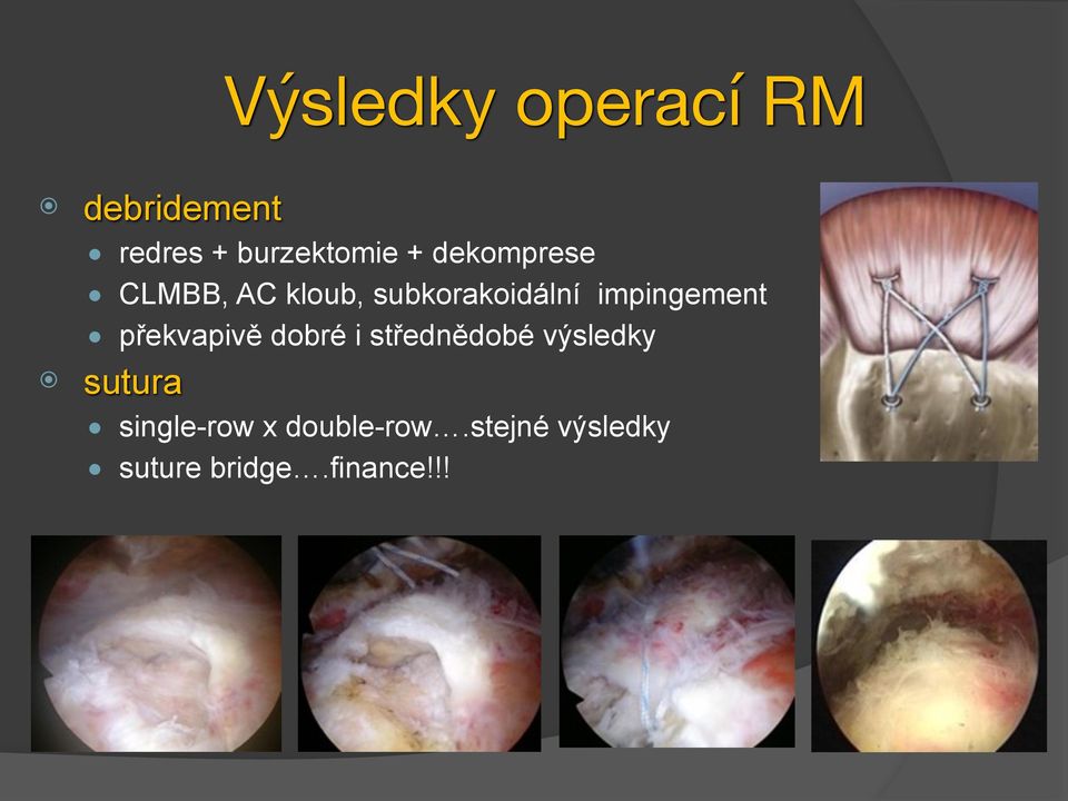 překvapivě dobré i střednědobé výsledky sutura