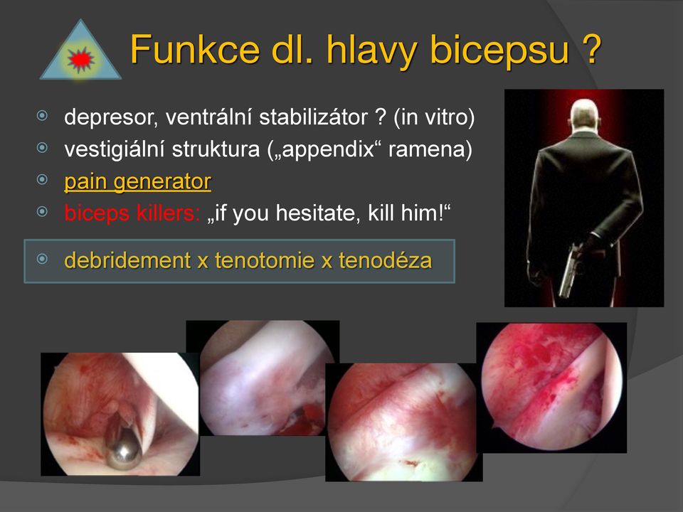 (in vitro) vestigiální struktura ( appendix