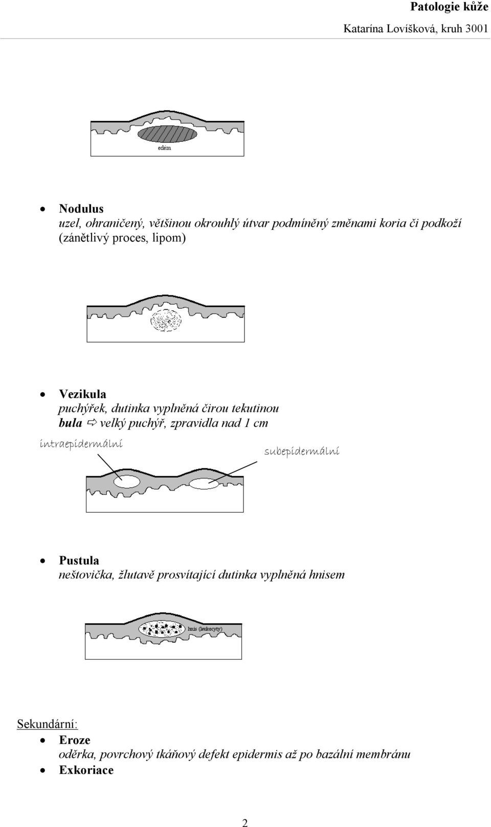 nad 1 cm intraepidermální subepidermální Pustula neštovička, žlutavě prosvítající dutinka vyplněná