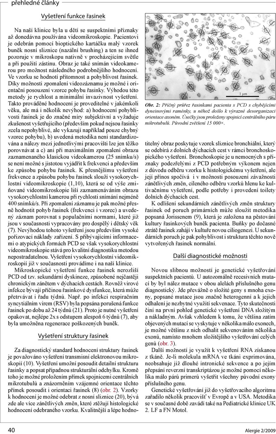 Pacientovi je odebrán pomocí bioptického kartáčku malý vzorek buněk nosní sliznice (nazální brushing) a ten se ihned pozoruje v mikroskopu nativně v procházejícím světle a při použití zástinu.