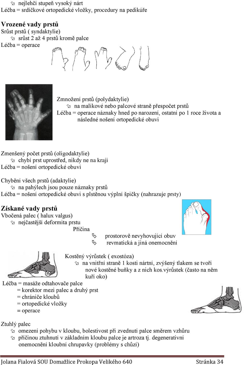 prst uprostřed, nikdy ne na kraji Léčba = nošení ortopedické obuvi Chybění všech prstů (adaktylie) na pahýlech jsou pouze náznaky prstů Léčba = nošení ortopedické obuvi s plstěnou výplní špičky