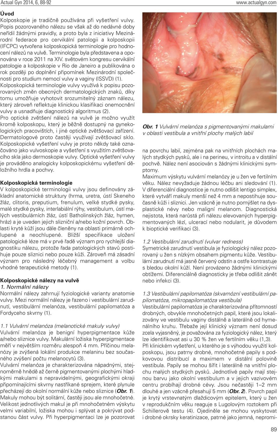 terminologie pro hodnocení nálezů na vulvě. Terminologie byla představena a oponována v roce 2011 na XIV.