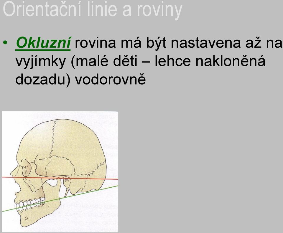 nastavena až na vyjímky