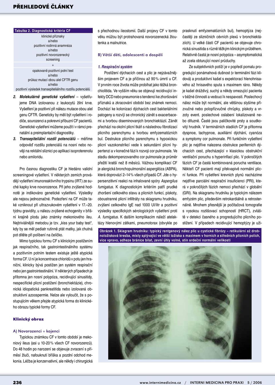 transepiteliálního rozdílu potenciálů 2. Molekulárně genetické vyšetření vyšetřujeme DNA izolovanou z leukocytů žilní krve. Vyšetření je pozitivní při nálezu mutace obou alel genu CFTR.