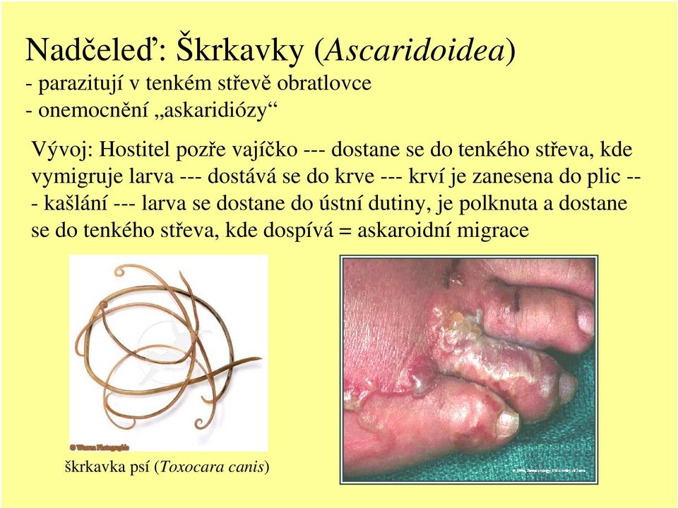 --- dostává se do krve --- krví je zanesena do plic -- - kašlání --- larva se dostane do ústní