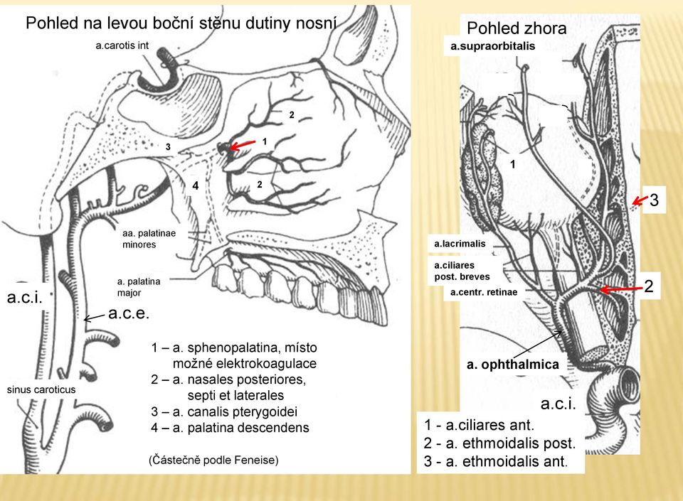 retinae 2 sinus caroticus 1 a. sphenopalatina, místo možné elektrokoagulace 2 a.