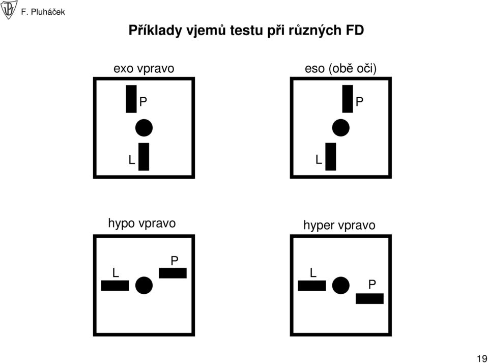 eso (obě oči) P L L hypo