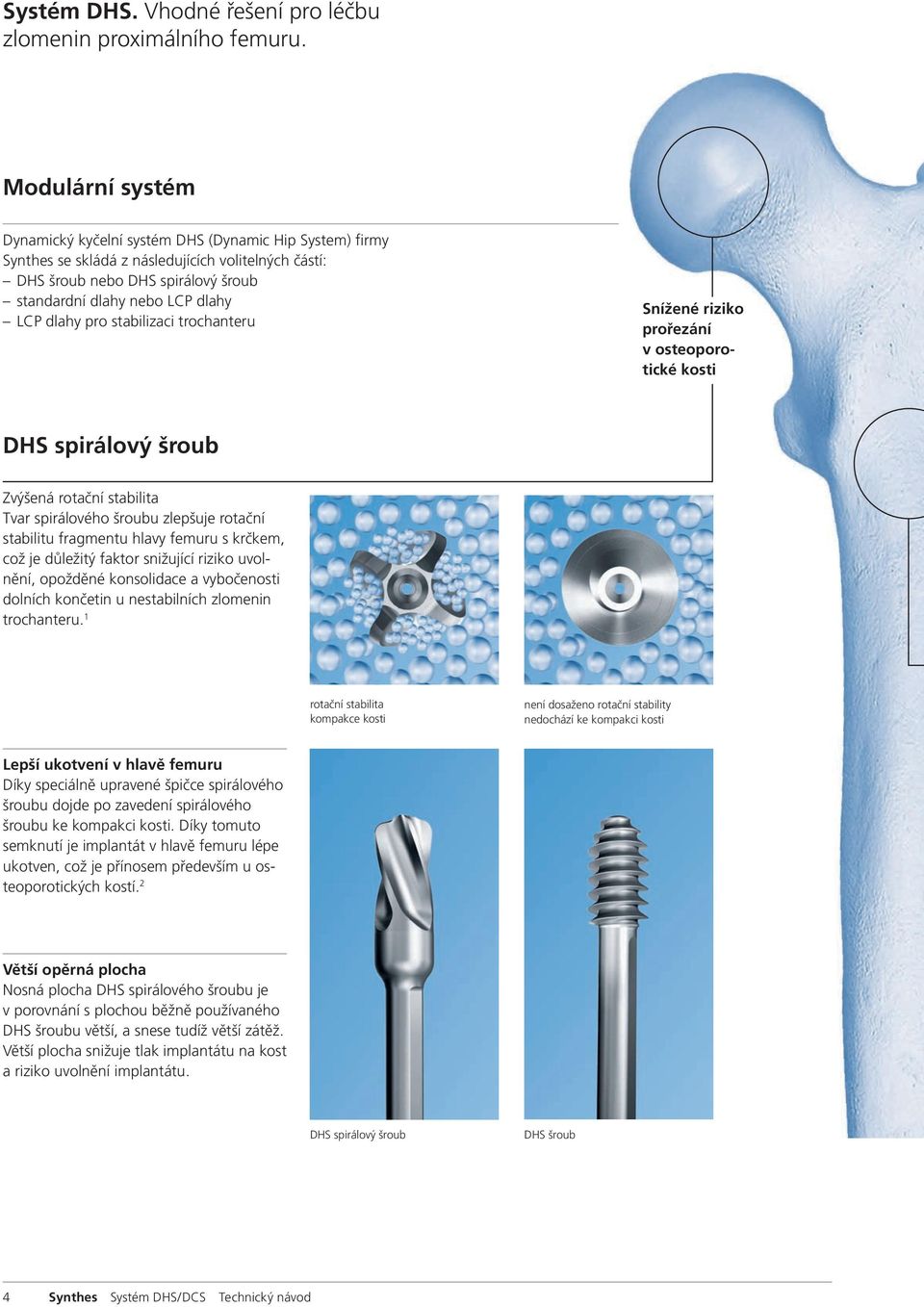 dlahy pro stabilizaci trochanteru Snížené riziko prořezání v osteoporotické kosti DHS spirálový šroub Zvýšená rotační stabilita Tvar spirálového šroubu zlepšuje rotační stabilitu fragmentu hlavy