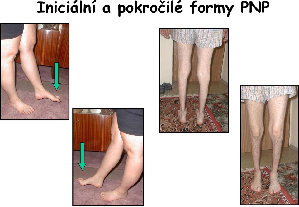 pokročilé