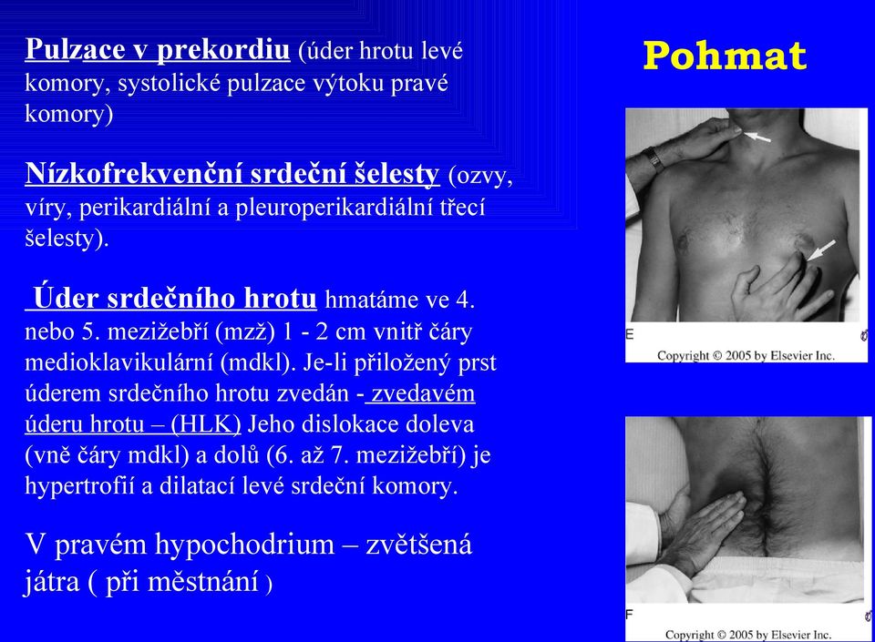 mezižebří (mzž) 1-2 cm vnitř čáry medioklavikulární (mdkl).