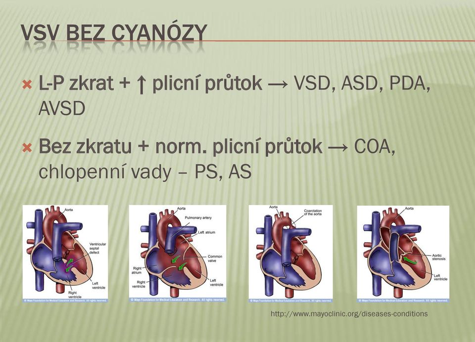 plicní průtok COA, chlopenní vady PS, AS