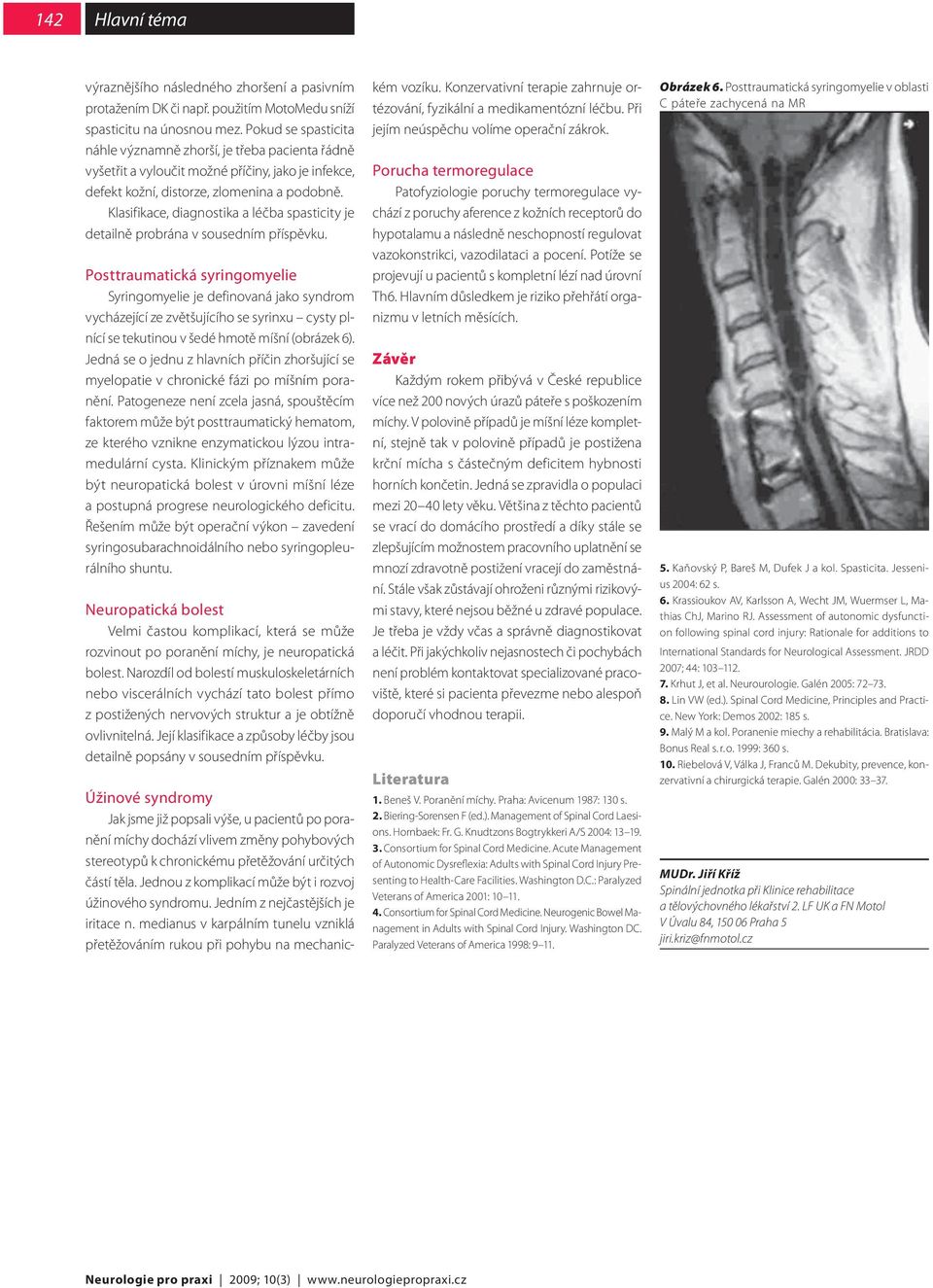 Klasifikace, diagnostika a léčba spasticity je detailně probrána v sousedním příspěvku.