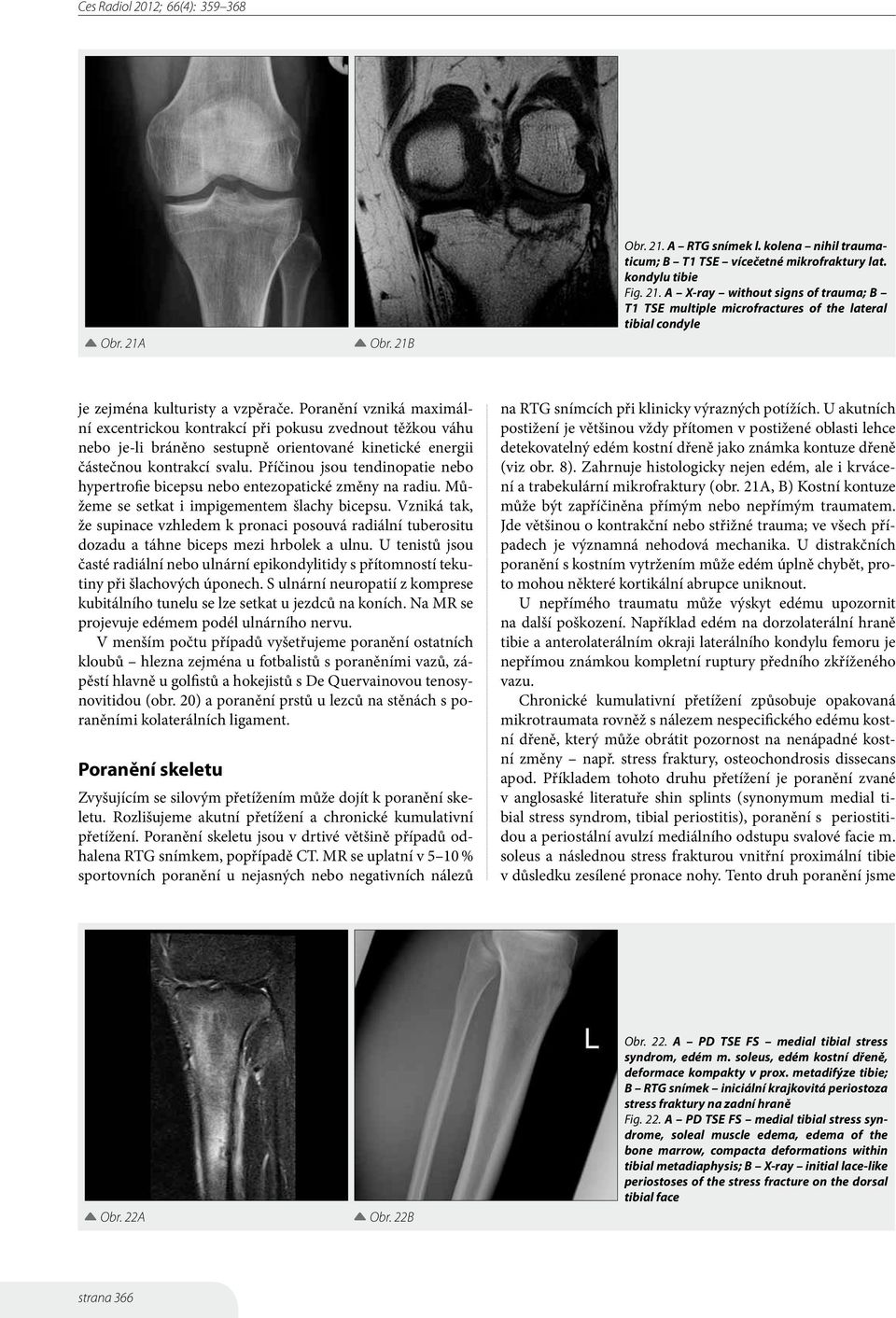 Příčinou jsou tendinopatie nebo hypertrofie bicepsu nebo entezopatické změny na radiu. Můžeme se setkat i impigementem šlachy bicepsu.