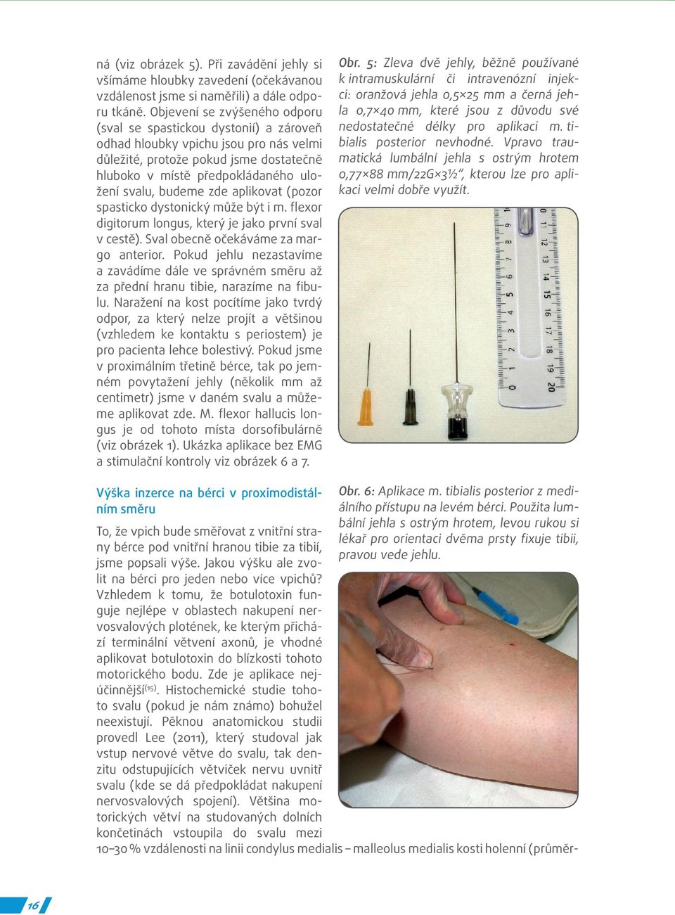 budeme zde aplikovat (pozor spasticko dystonický může být i m. flexor digitorum longus, který je jako první sval v cestě). Sval obecně očekáváme za margo anterior.