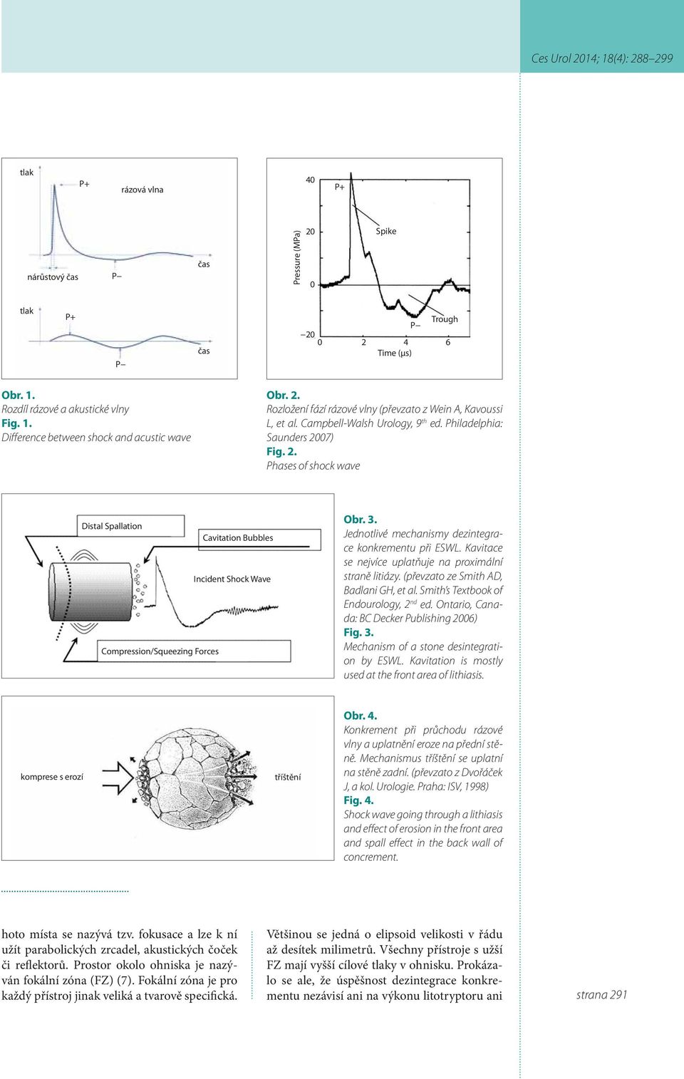 07) Fig. 2. Phases of shock wave Distal Spallation Cavitation Bubbles Incident Shock Wave Compression/Squeezing Forces Obr. 3. Jednotlivé mechanismy dezintegrace konkrementu při ESWL.