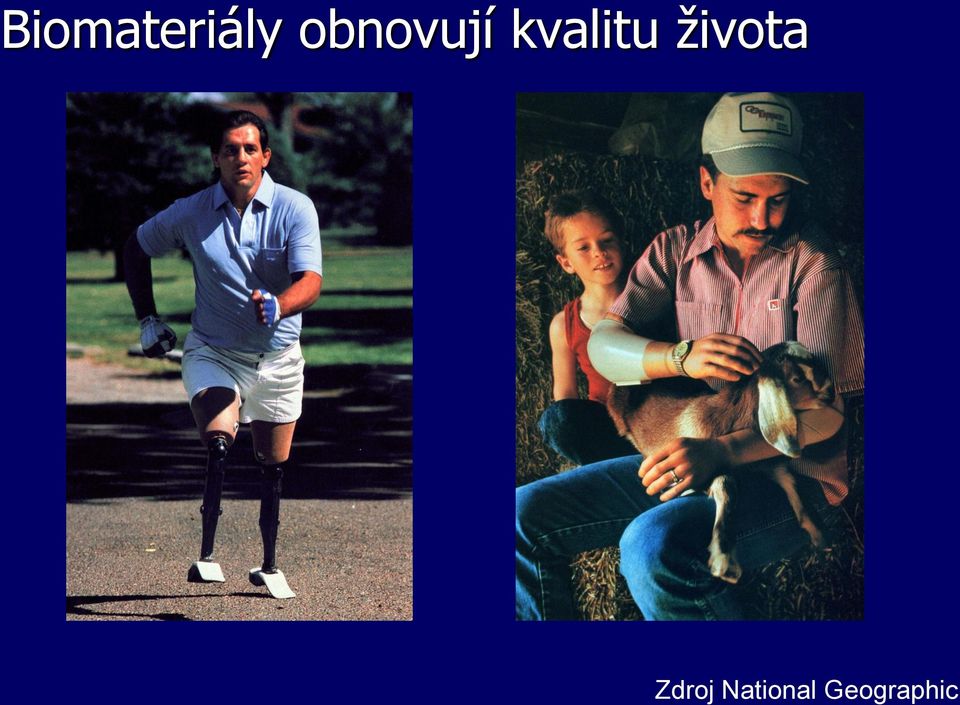 kvalitu života